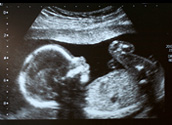Sonogram with almost fully grown baby